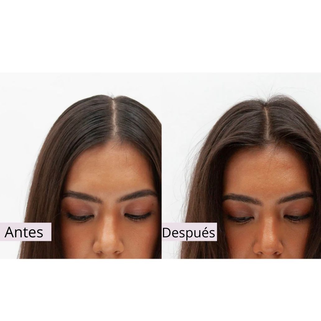 Antes y despu&eacute;s Peptide Puff 1